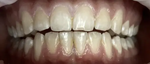 before-gbt-1