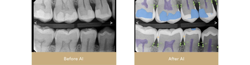 AI X-ray Analysis before and after